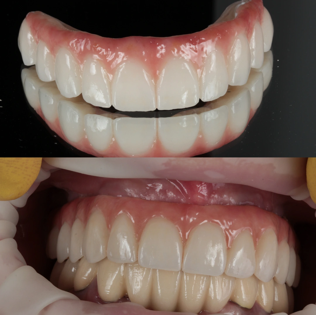 імплантація зубів Київ