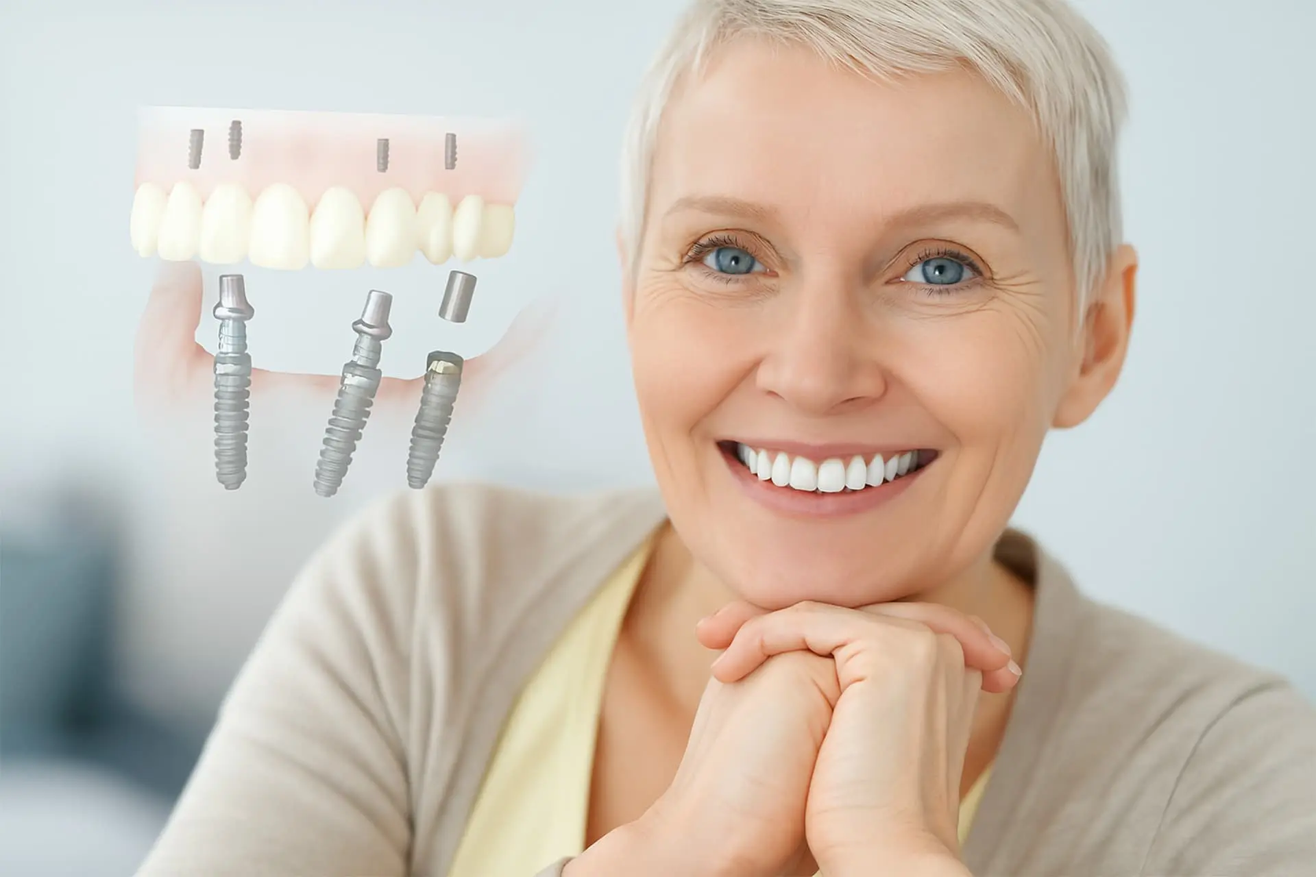 імплантація зубів в Київі