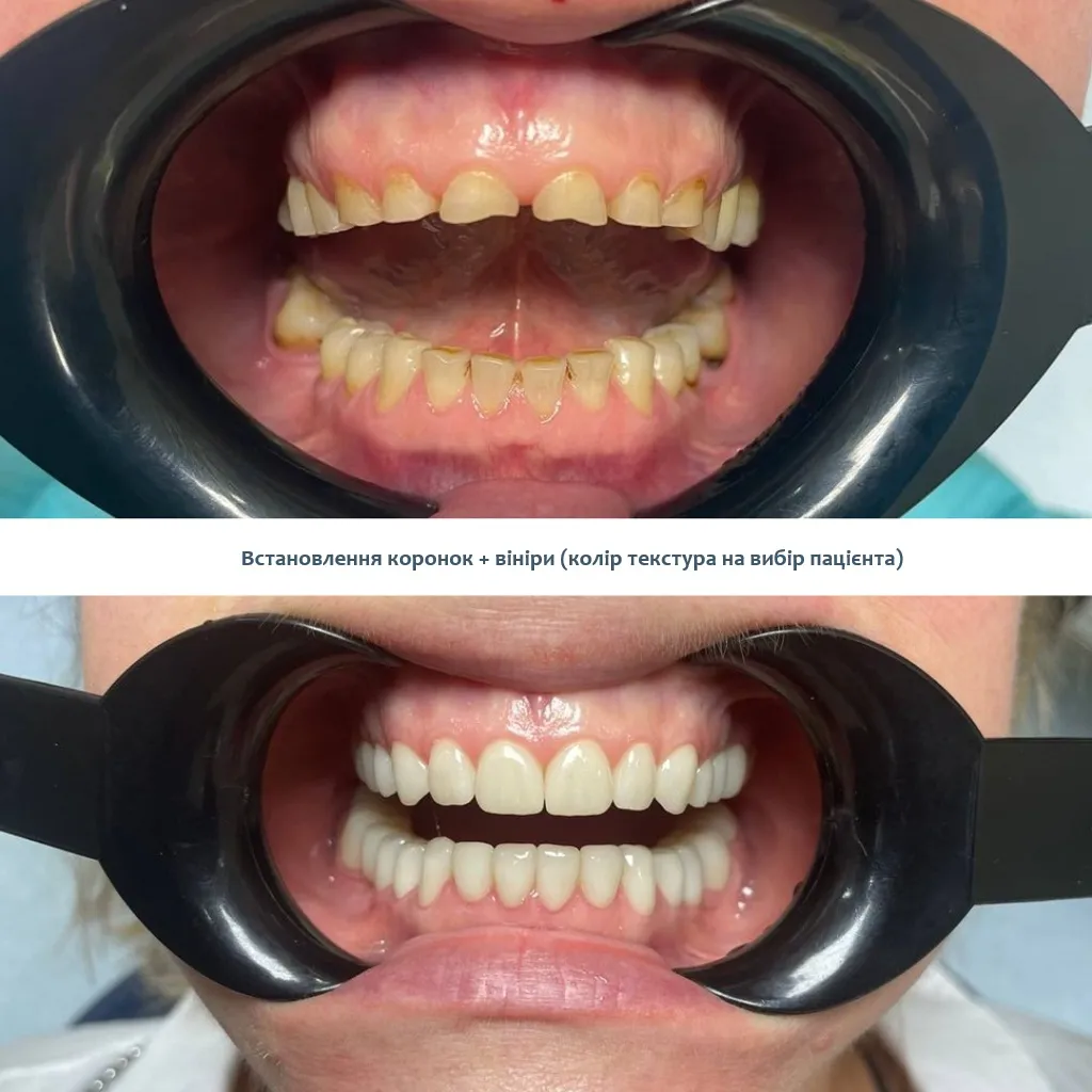 Ортодонт з досвідом Київ