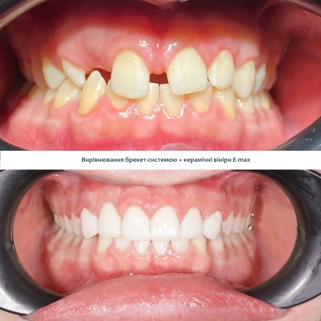 Cristaline елайнери ціна під ключ Київ