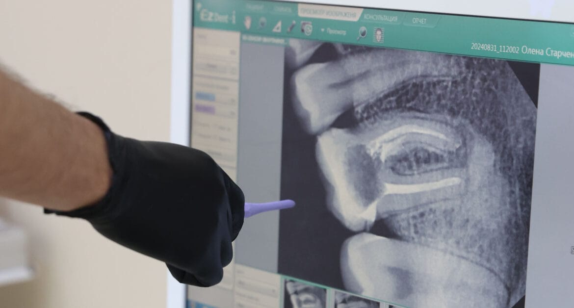 КТ зубів, сканування, ренген