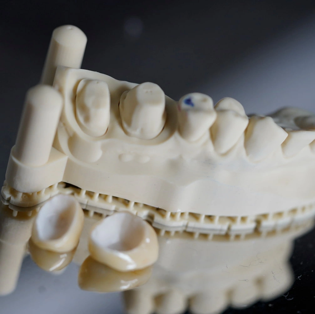 ціна керамічної коронки соломянка