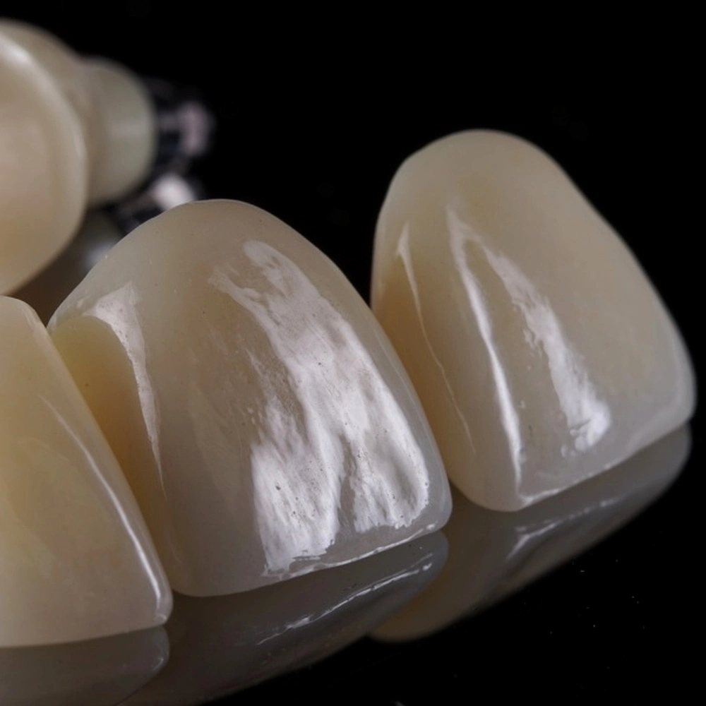 коронки з цирконію поставити