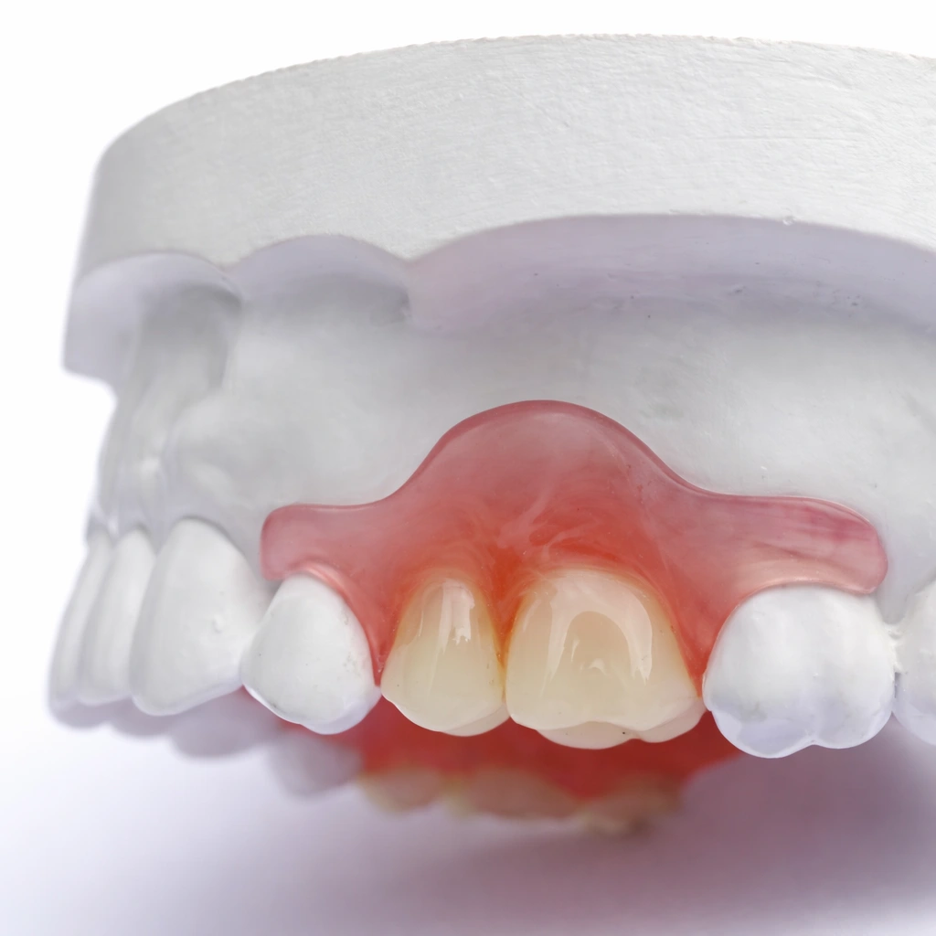 протез метелик соломянський район київ