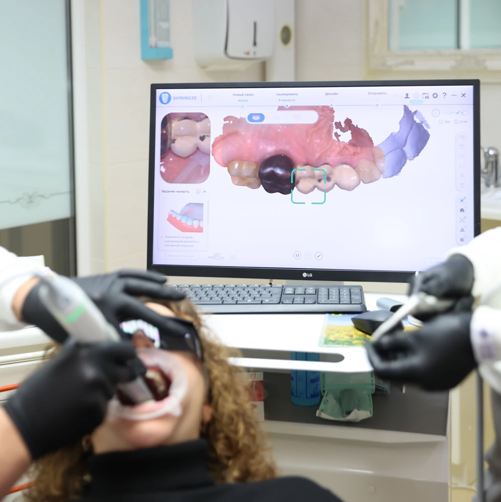 Установити зубний міст Соломянка Київ