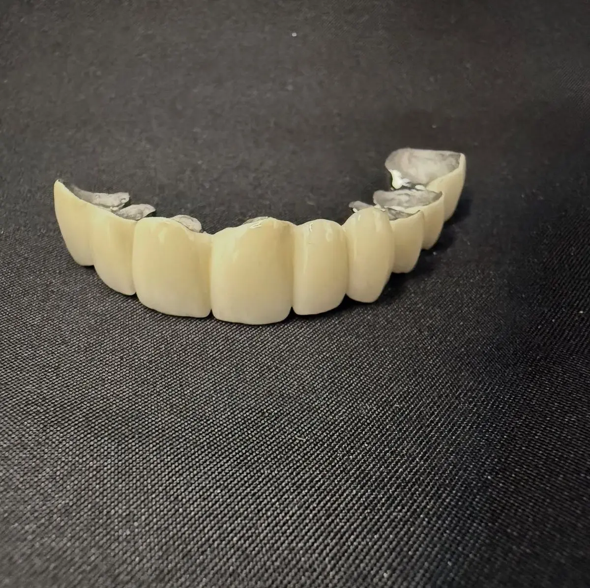 Металокерамічна коронка міст