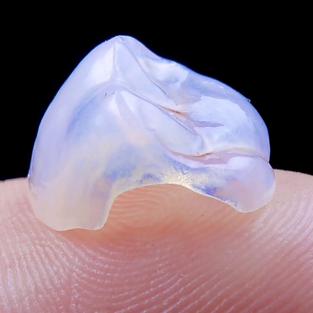 як виглядають вініри ціна київ